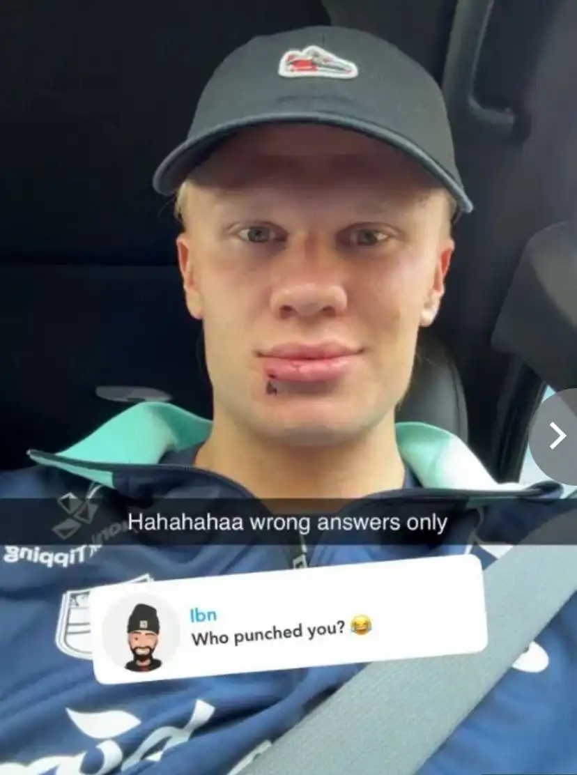 إصابة هالاند