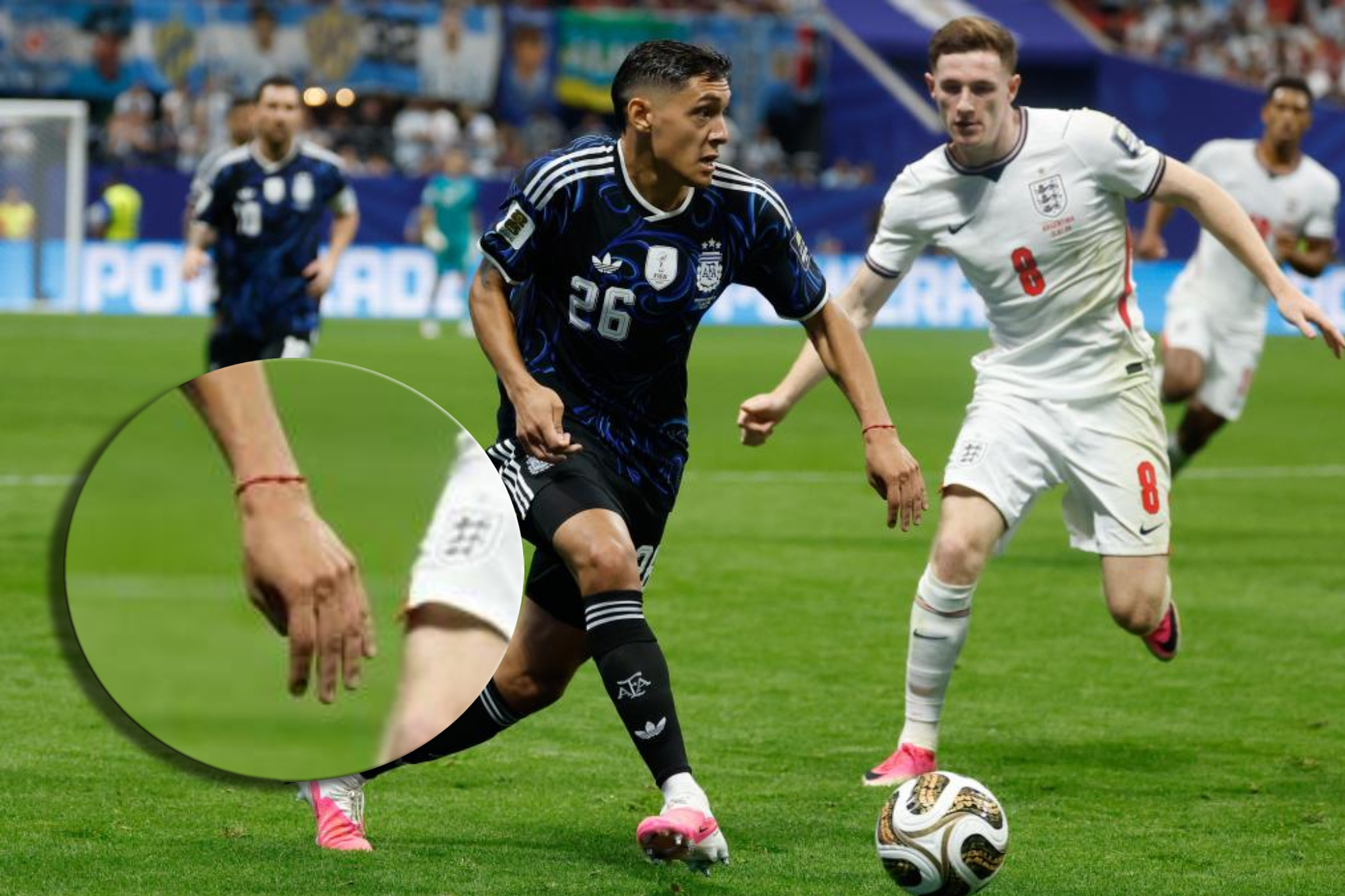 Pulseras de Argentina frente a Inglaterra