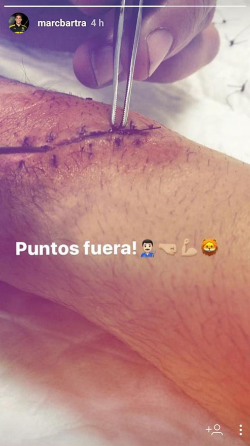 Marc Bartra recordó el ataque al autobús: "Me daba igual que me cortaran el brazo, sólo pensaba en que estaba vivo"